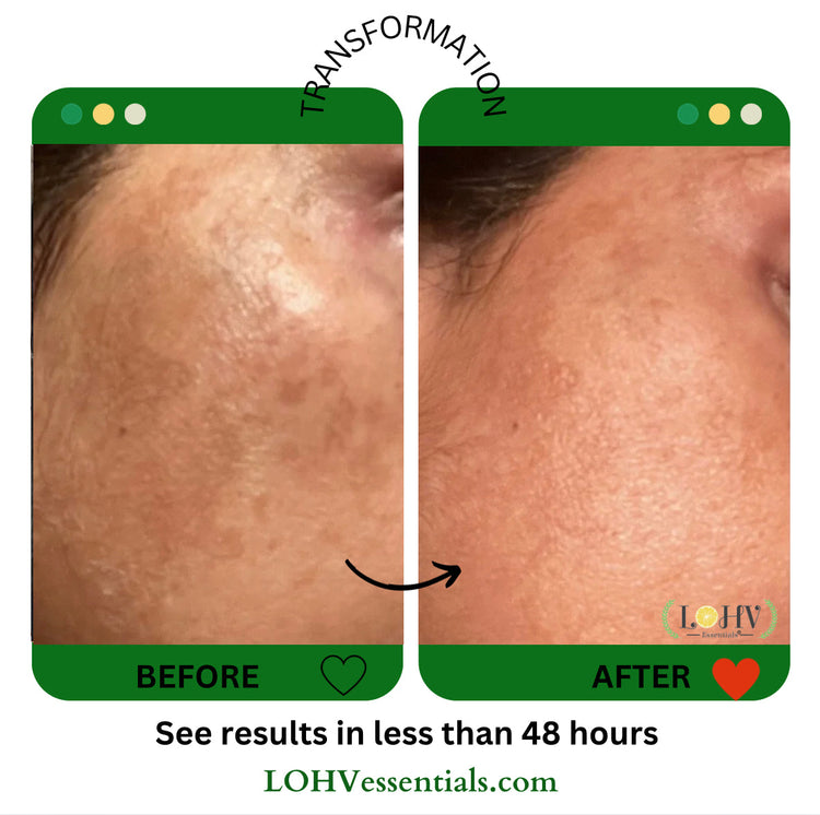 PREMIUM 100% VEGAN Rejuvenating JELLY FACE MASK With Retinol + Turmeric + Aloe Vera + Lactic acid + Rosemary Leaf